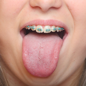 Tongue with Taste Buds | Dr. Wolnik