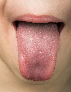 Human tongue protruding out | Dr. Wolnik