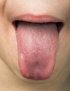 Human tongue protruding out | Dr. Wolnik