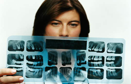 woman looks at silver tooth fillings on a dental x-ray